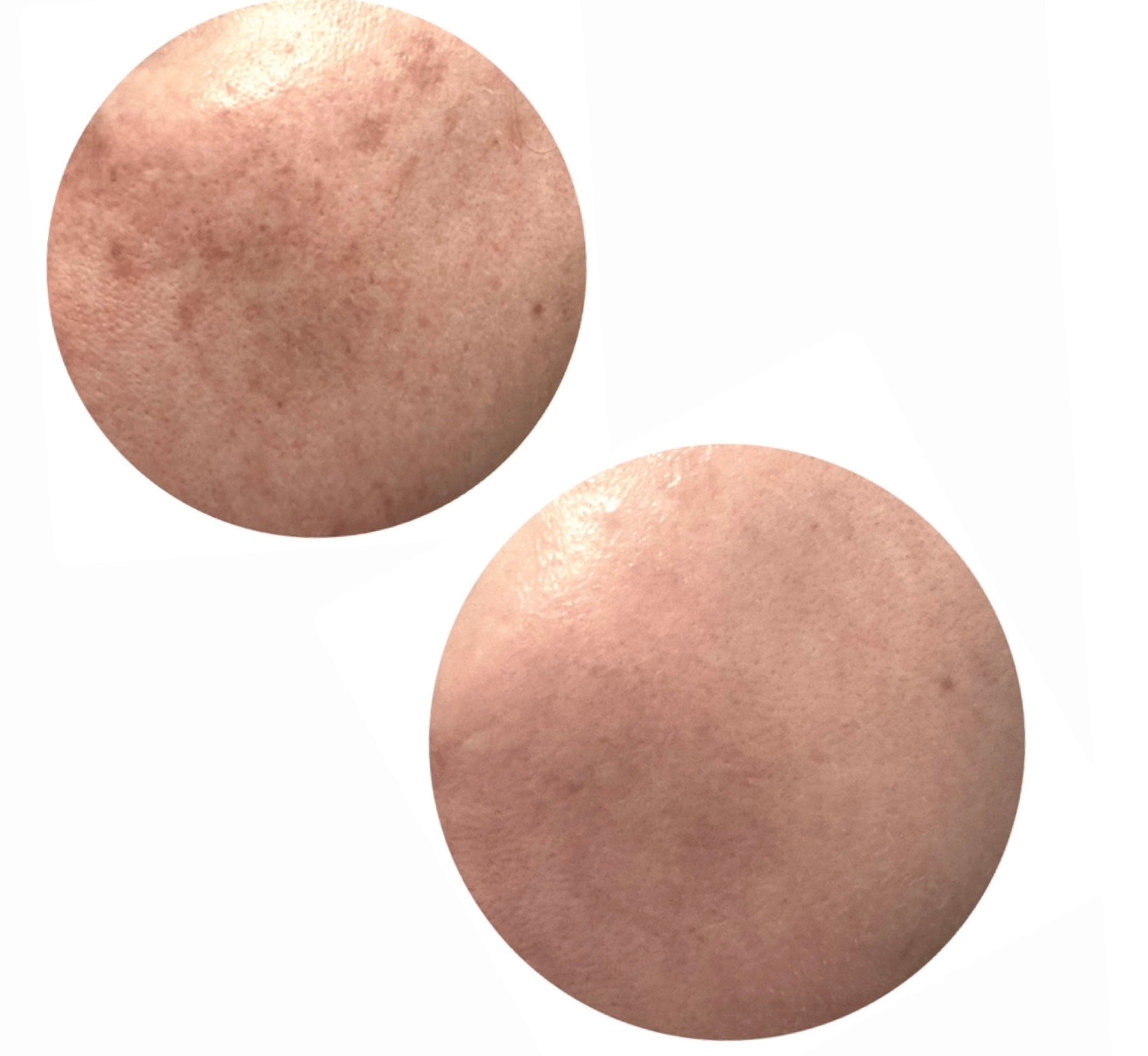 GENTLE ACID TONER