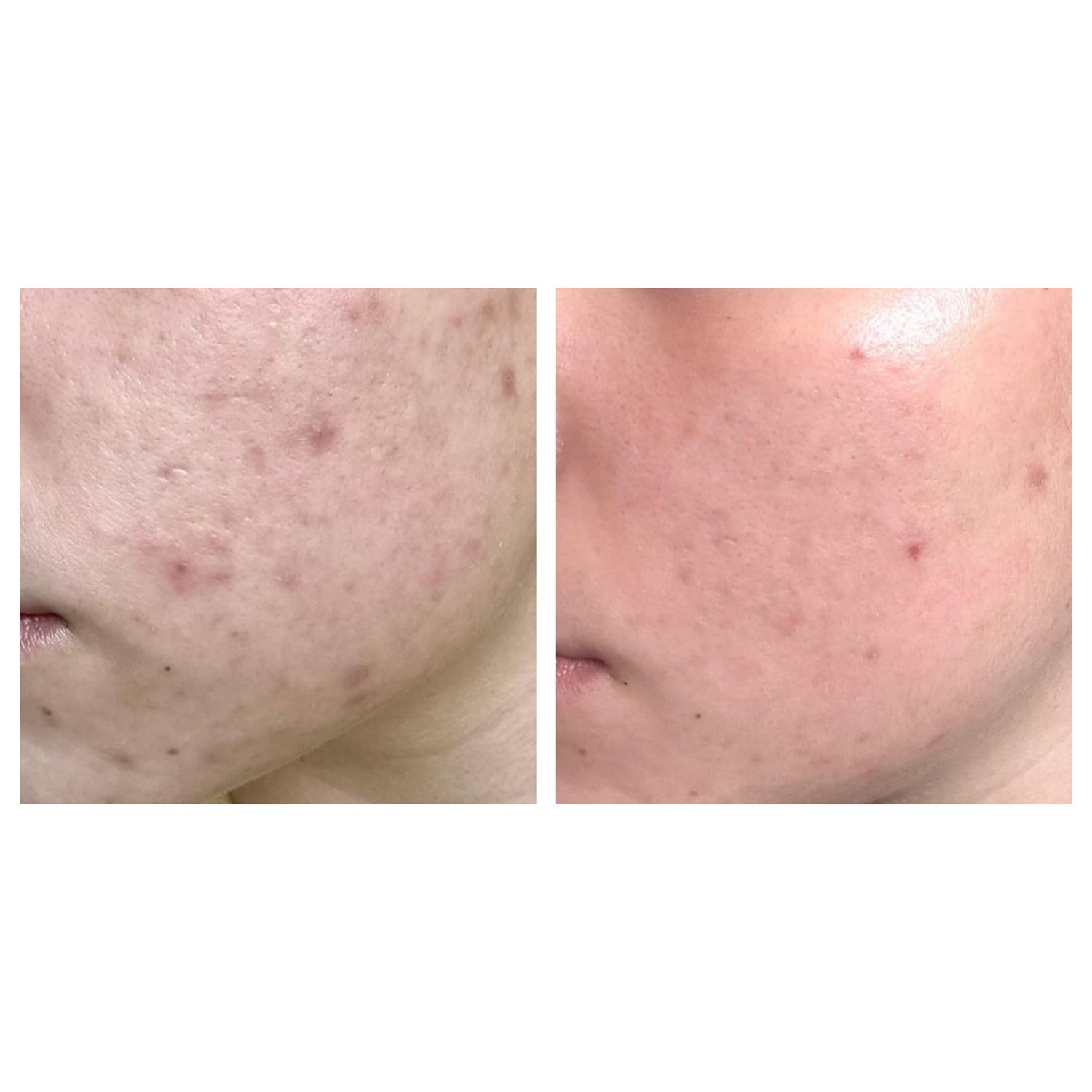 olibanum — spot treatment