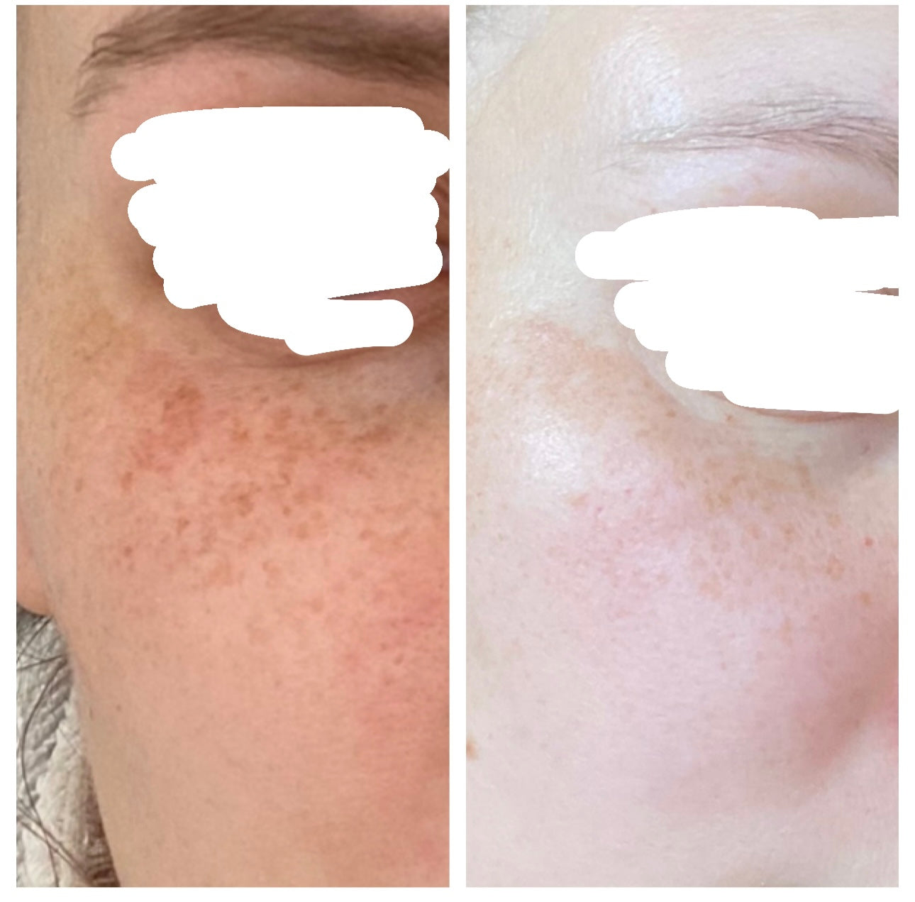 olibanum — spot treatment