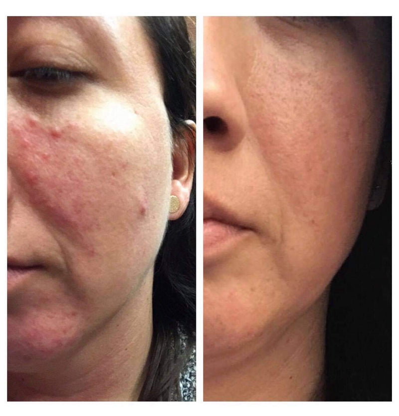 sunshine elixir serum™